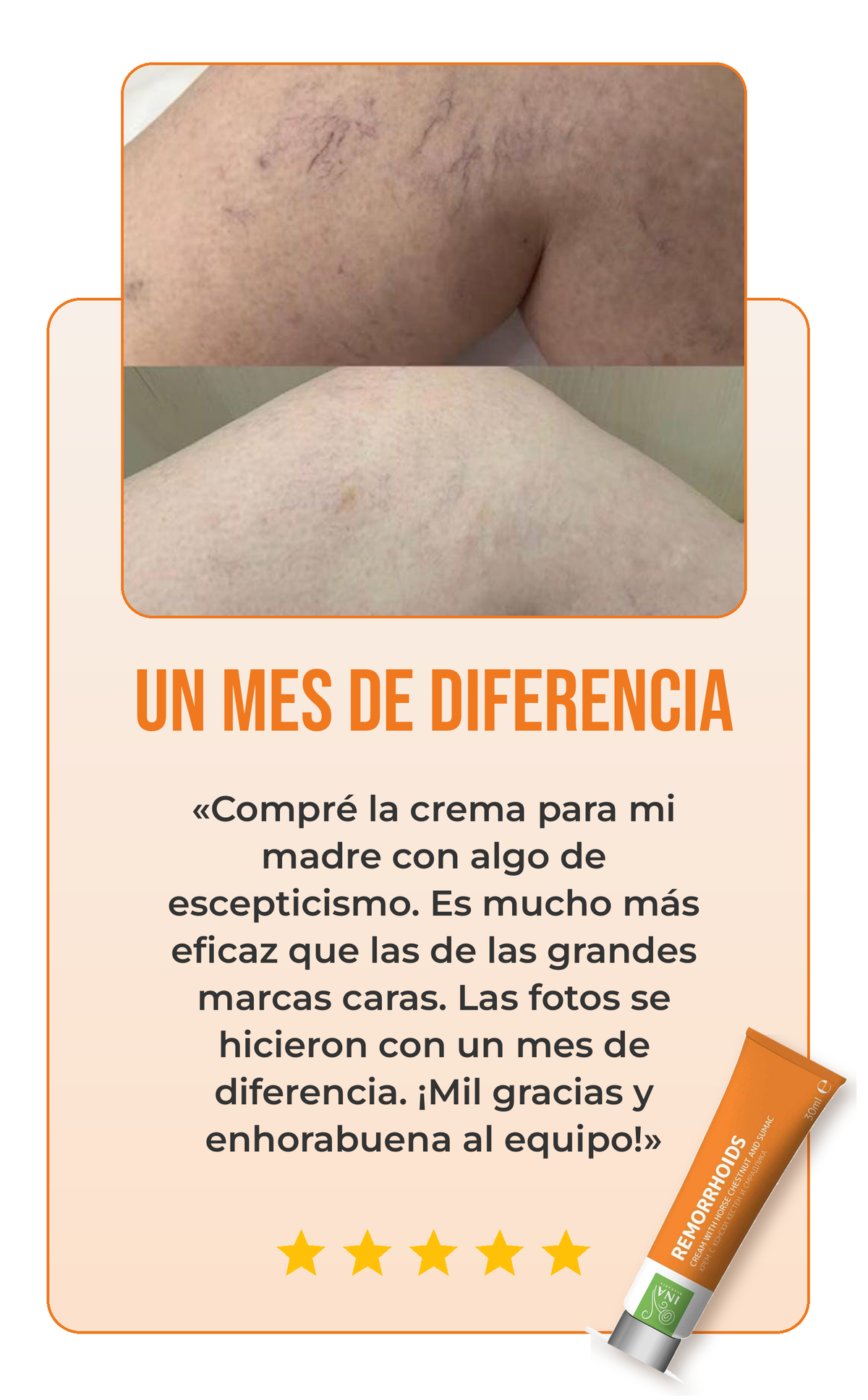 Reseña crema para las várices 1