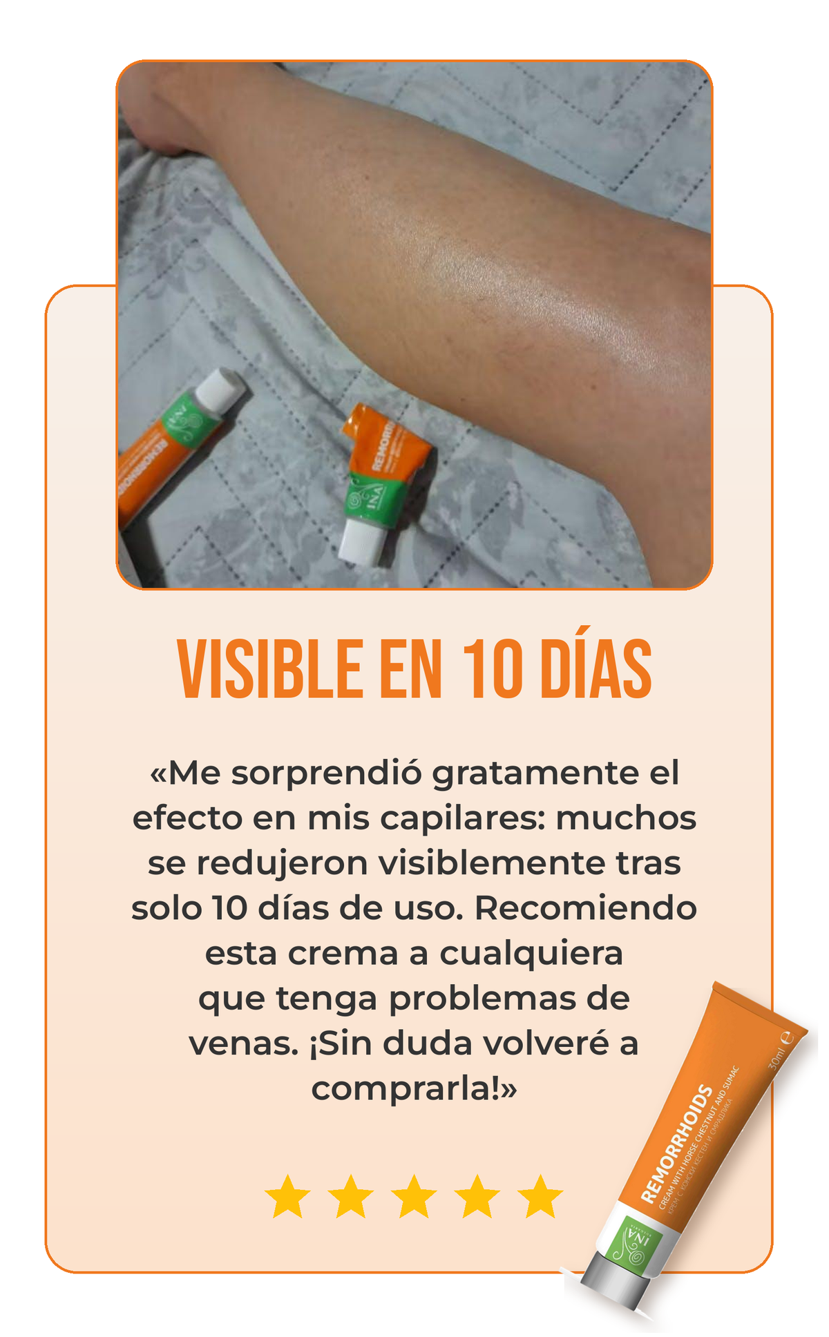 Reseña crema para las várices 2