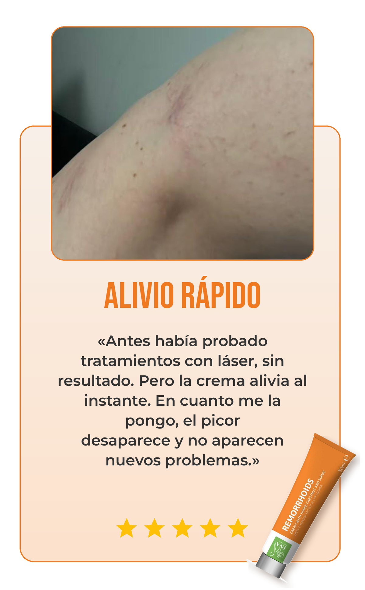 Reseña crema para las várices 3